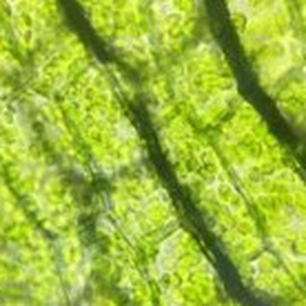 Plant cells under microscope