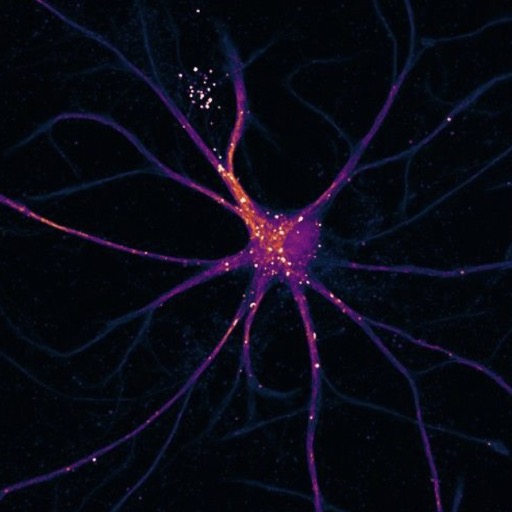 Fluorescent neuron under microscope