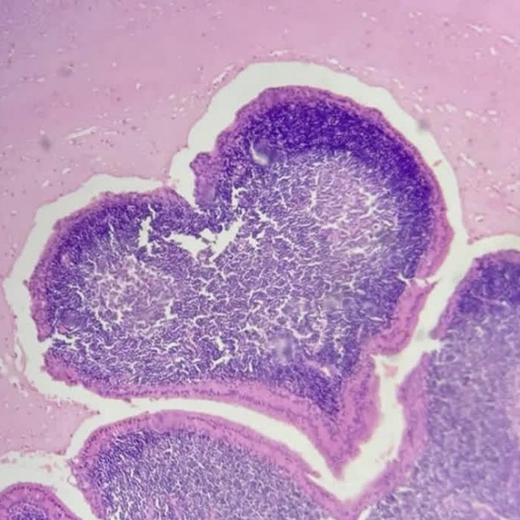 Heart-shaped tissue under microscope